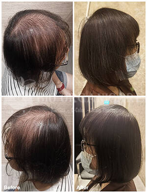 bio organicare, scalp treatment, hair treatment, hair growth, hair regrowth, hair care, scalp solution, hair solution, scalp problem, hair problem, hair centre in singapore, singapore best hair growth, singapore hair loss treatment, best hair loss treatment singapore, natural ingredient, organic ingredient, hair repair, scalp repair, hair salon, organic hair care, natural hair care, hair bath, hair mask, healthy hair, hair loss, hair thinning, greying hair, oily scalp, greasy scalp, itchy scalp, dandruff, flakes, sensitive scalp, alopecia areta, chemical residue, bacteria infected scalp, oil clog scalp, scalp inflammation, dead toxic cell layers, stress hair loss, menopause hair loss, hormonal hair loss, premature hair loss, traction alopecia, chemical hair loss, androgenetic alopecia, ageing scalp hair loss, post natal hair loss, male pattern hair loss, female pattern hair loss, truth hair loss, daily vanity