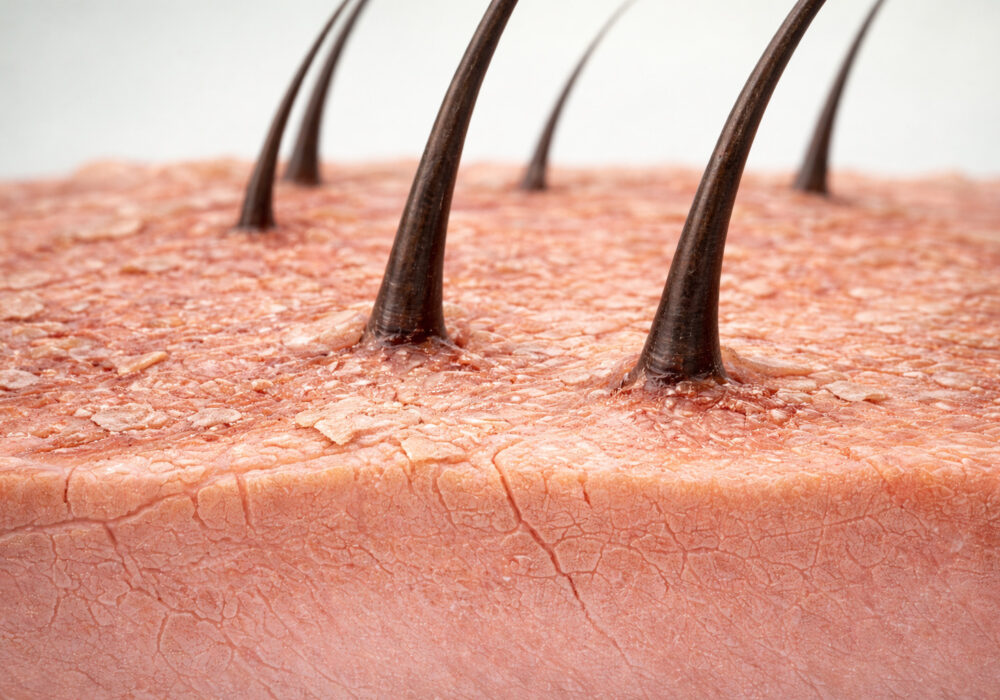 Hair Bath - Why Over-cleansing can worsen scalp condition