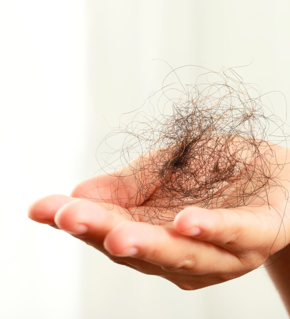 Hair Loss Concerns - Hair Fall Page - Why Does Hair Fall Happen