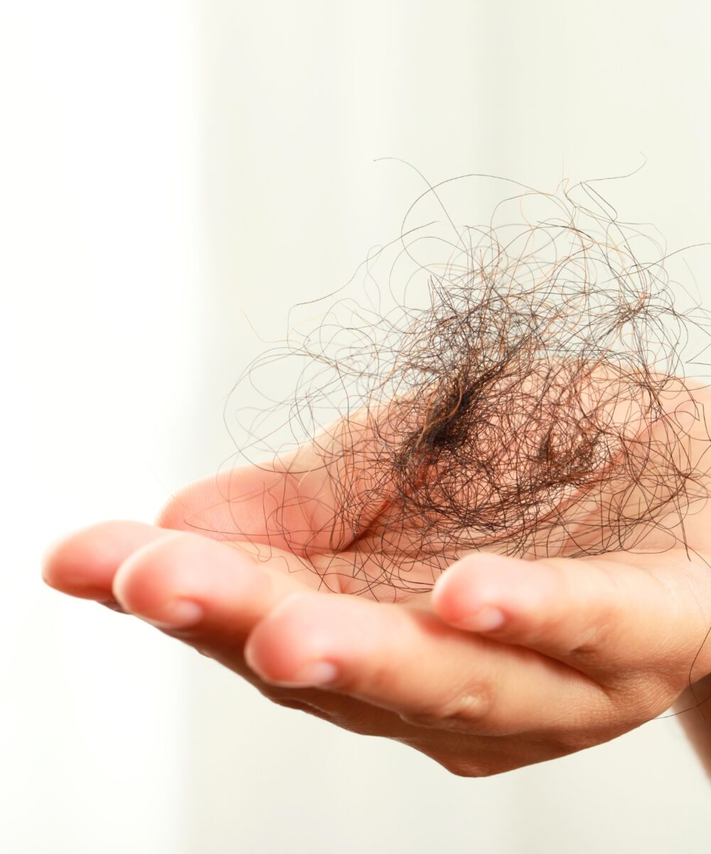 Hair Loss Concerns - Hair Fall Page - Why Does Hair Fall Happen