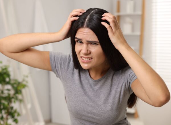 5 Signs Your Scalp Is Unhealthy 5 Signs Your Scalp Is Unhealthy