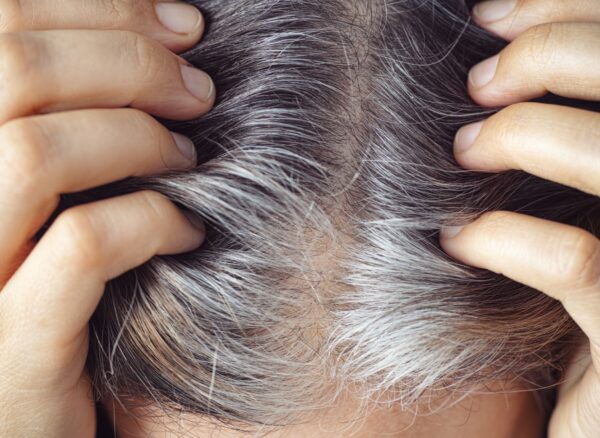 Grey Hair Before 40 Grey Hair Before 40