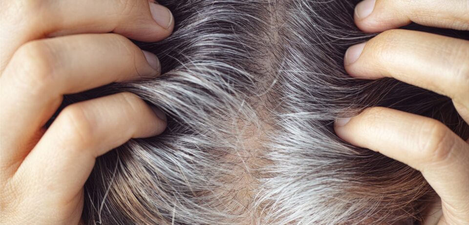 Grey Hair Before 40