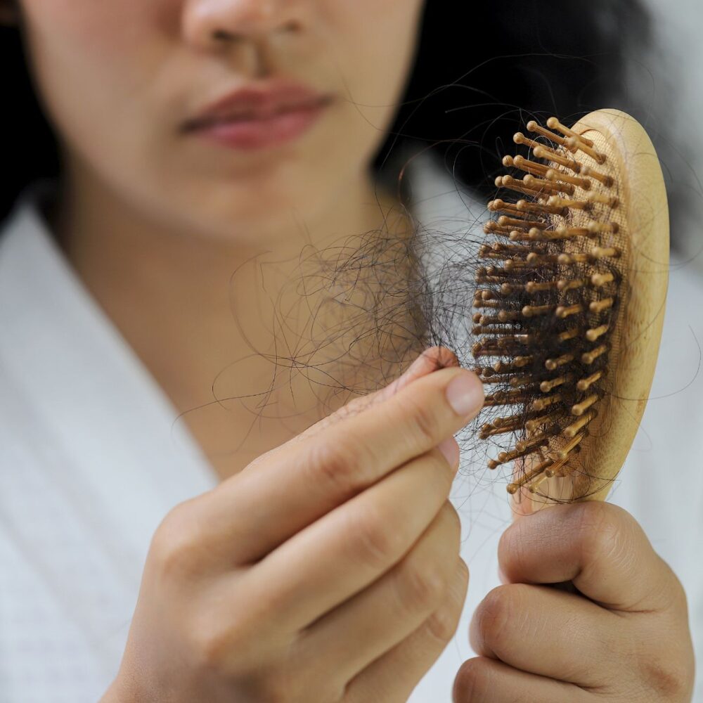 Postpartum Hair Loss