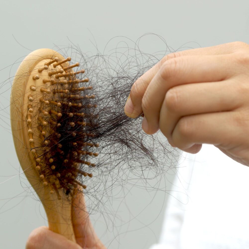 Postpartum Hair Loss 2