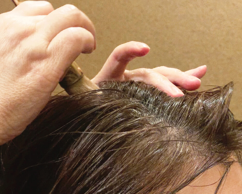 Demodex Mites Elimination Therapy