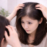 Hair Thinning & Ageing Scalp Hair Thinning & Ageing Scalp