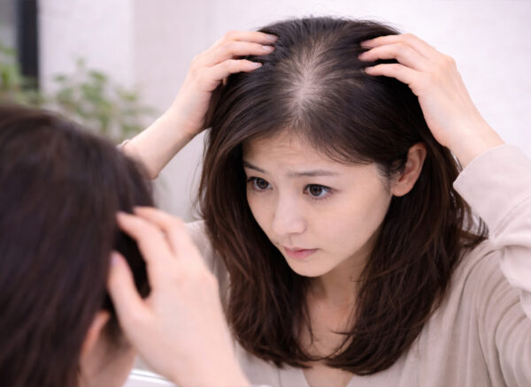 Hair Thinning & Ageing Scalp Hair Thinning & Ageing Scalp