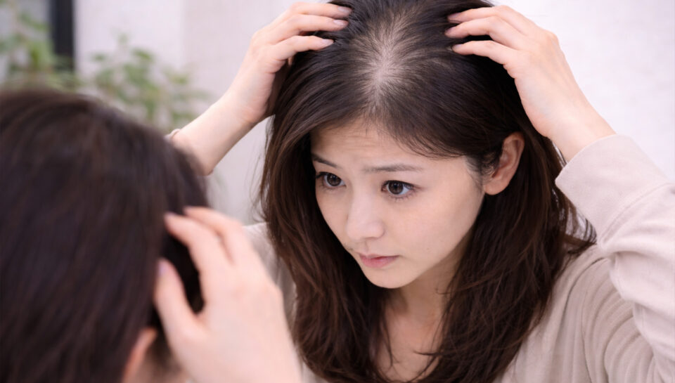 Hair Thinning & Ageing Scalp