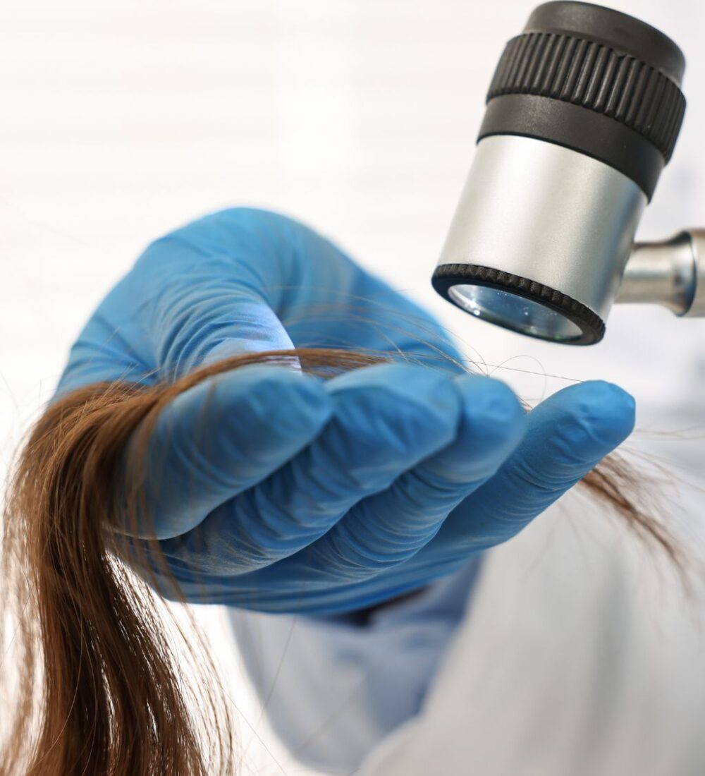 Scalp Analysis & Consultation CV