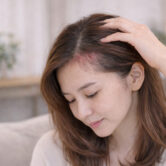 Sensitive Scalp vs Allergic Reaction