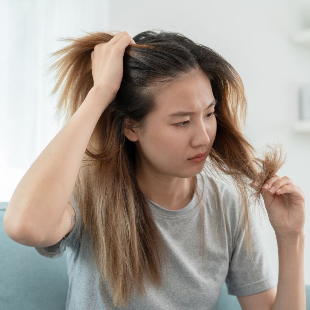 Postpartum Hair Loss