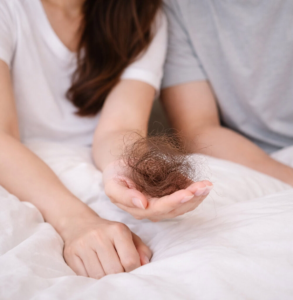 S.H.C Hair Loss - FAQ