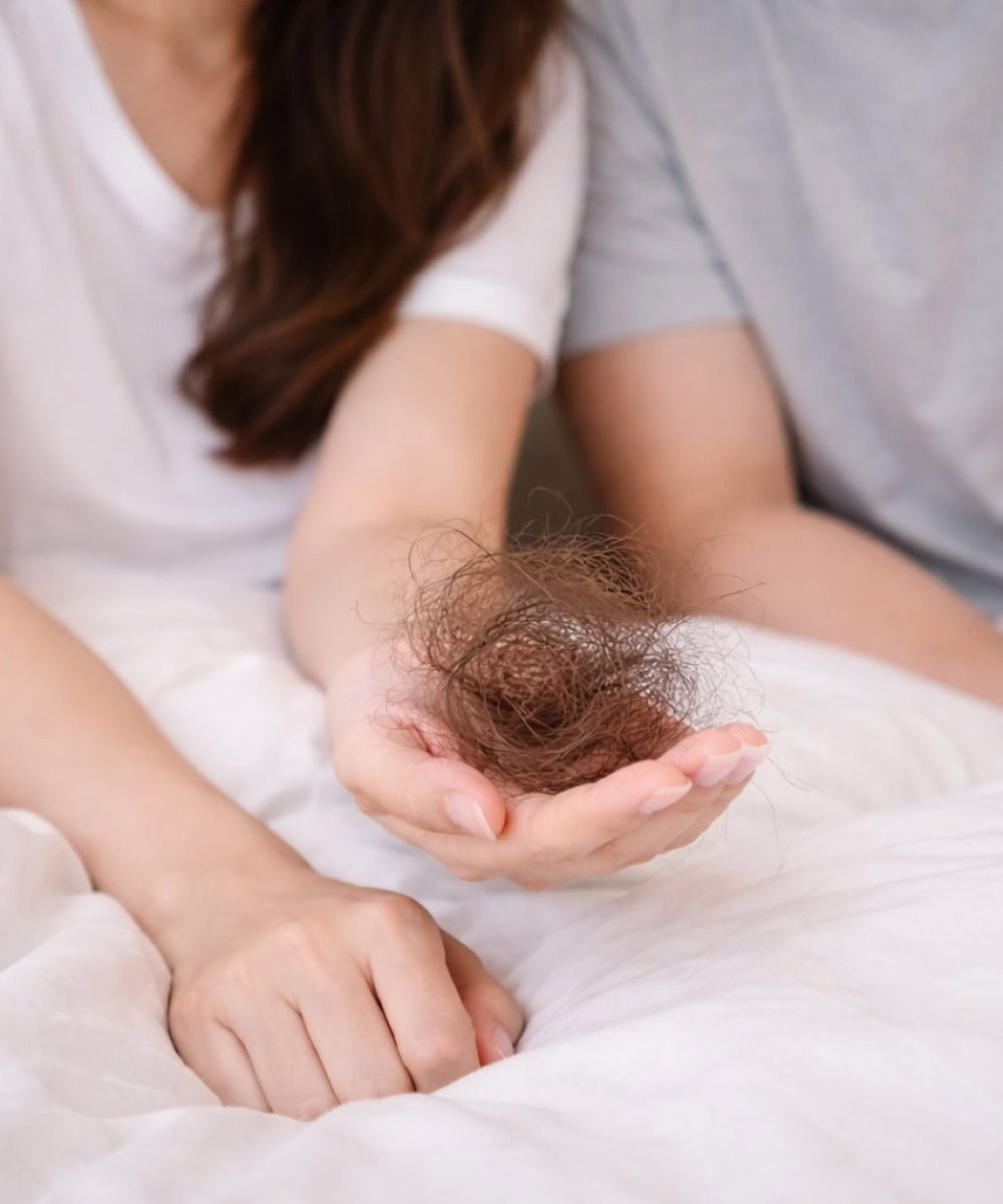 S.H.C Hair Loss - FAQ
