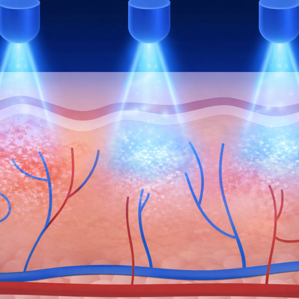 S.H.C Sensitive - How Bio Organicare Approaches