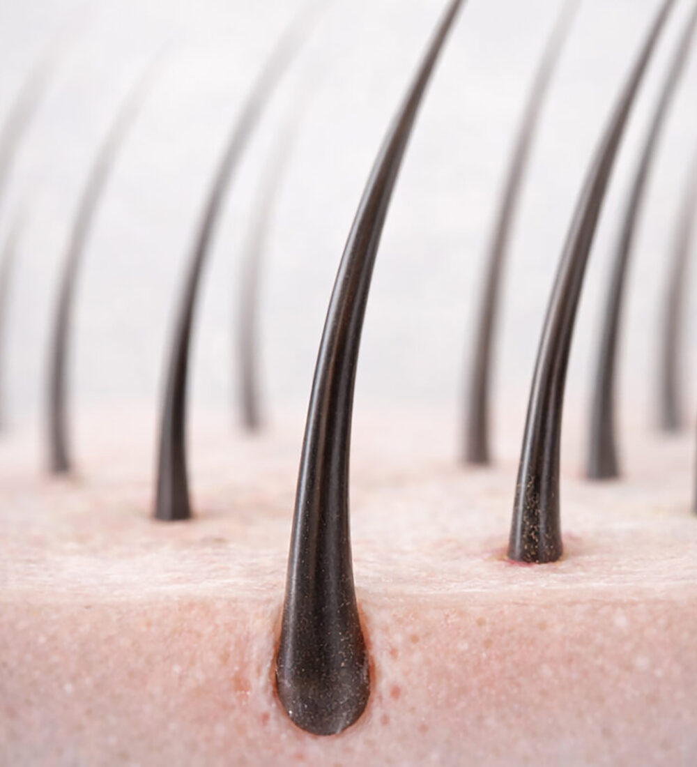 HomePage-WHY-SCALP-FIRST-CARE-MATTERS-768x800