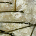 Dandruff - Before (Dandruff _ Oily Scalp _ Sensitive)