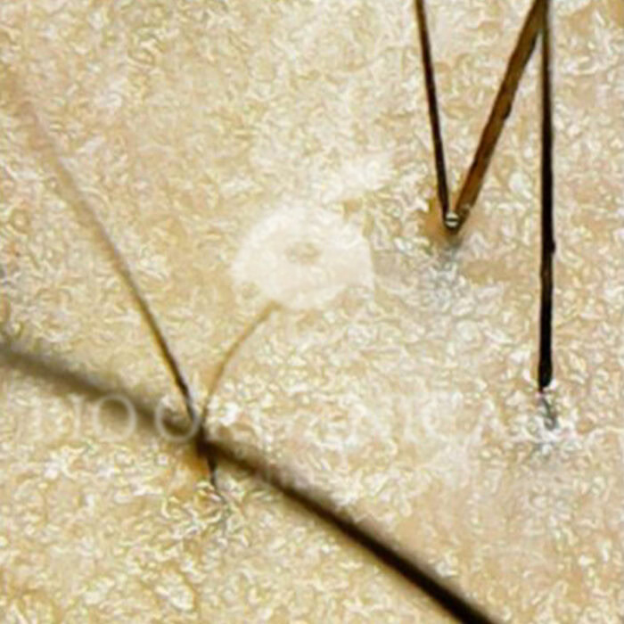 Dry Flaky - After (Dandruff _ Oily Scalp _ Sensitive)