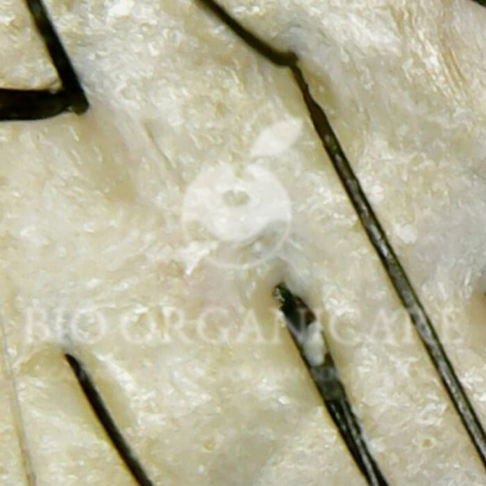 Fungal - After (Advanced Cases)
