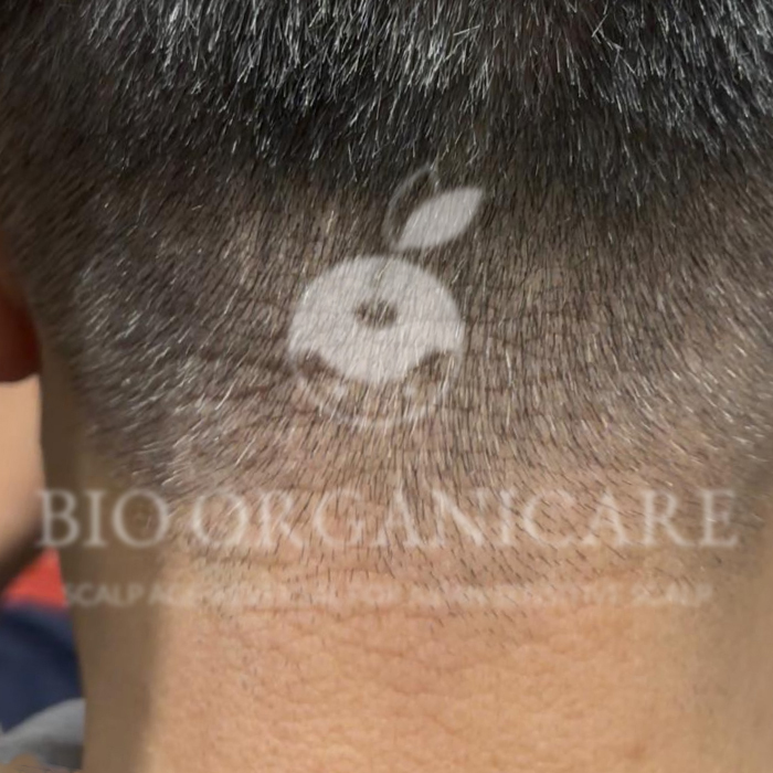 Sensitive Scalp - After (Dandruff _ Oily Scalp _ Sensitive)