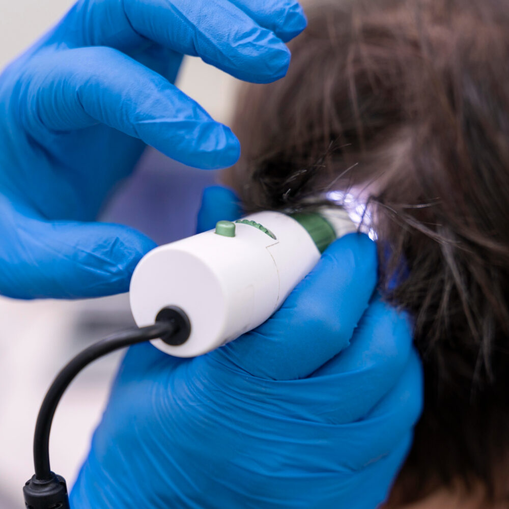 Scalp Analysis