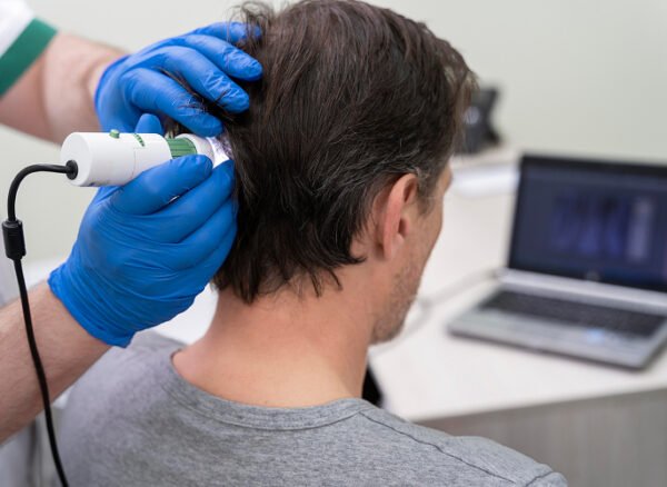 Man undergoing a professional scalp analysis for hair loss treatment.