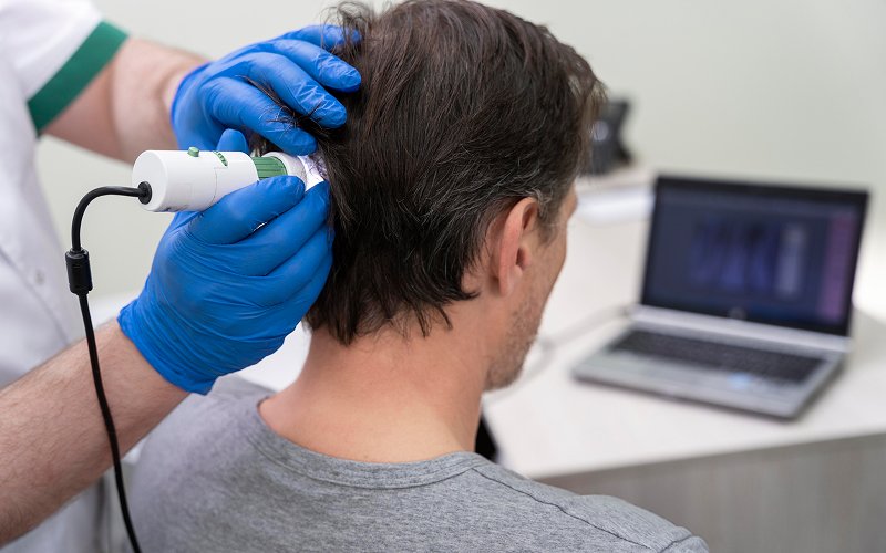 Man undergoing a professional scalp analysis for hair loss treatment.