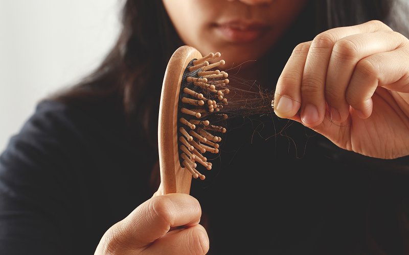 Woman holding a hairbrush full of fallen hair strands.