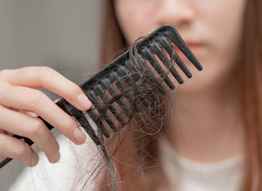 Asian girl with hair loss problem,