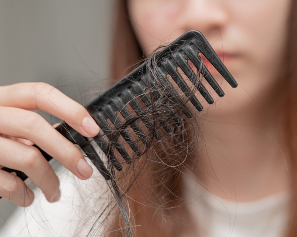 Asian girl with hair loss problem,