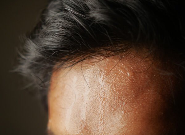 Close-up of forehead and hairline with heavy perspiration drops.