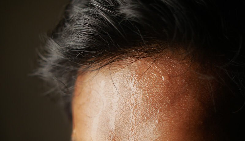 Close-up of forehead and hairline with heavy perspiration drops.