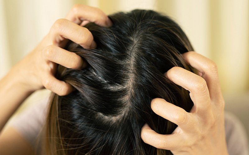Woman scratching irritated and itchy scalp with both hands.