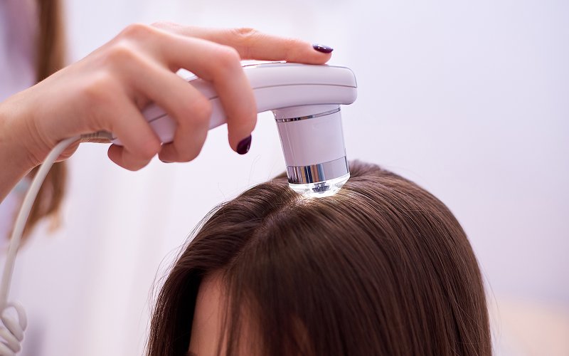 Microscopic-scalp-examination-analyzing-scalp-microbiome-and-health
