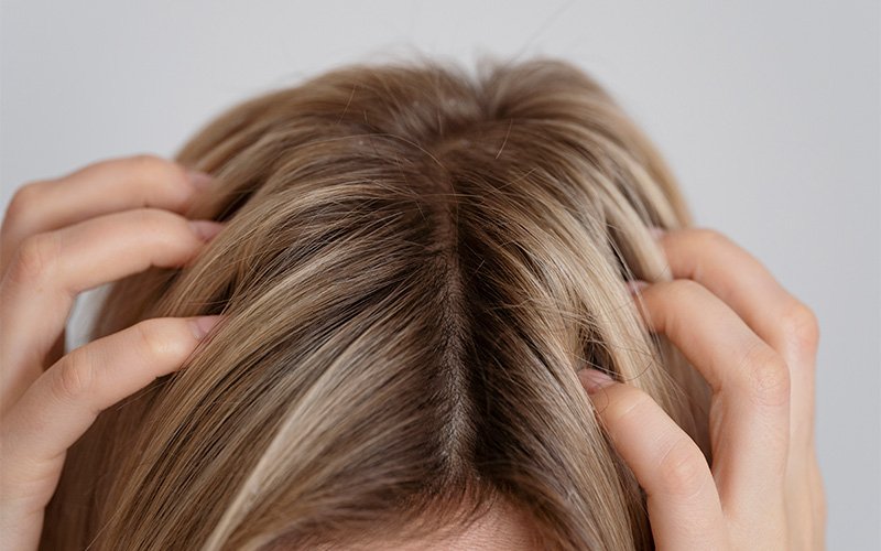 close-up-woman-scratching-scalp-hair-part
