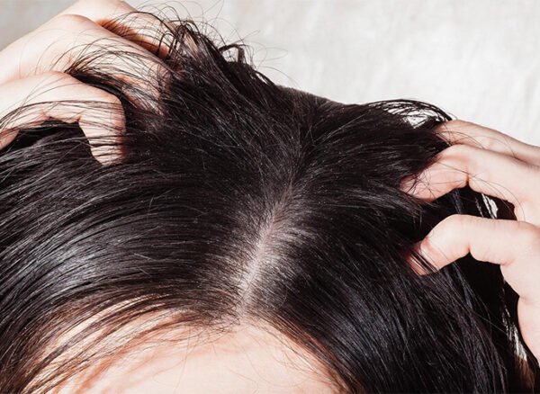 Close-up of oily scalp and roots during hair check.