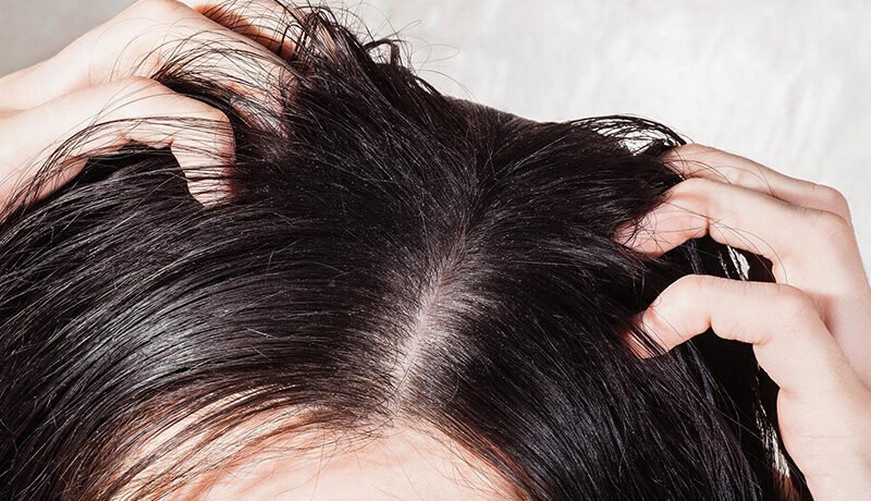 Close-up of oily scalp and roots during hair check.