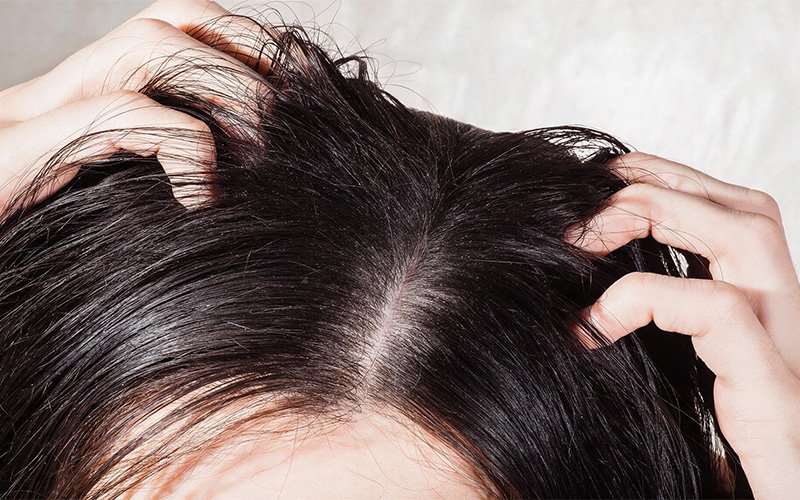 Close-up of oily scalp and roots during hair check.