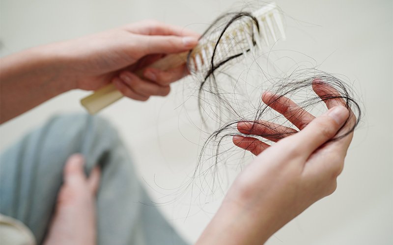 Woman holding clumps of fallen hair after combing long hair.