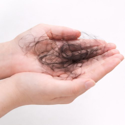 Common Scalp Concerns-Hair Shedding