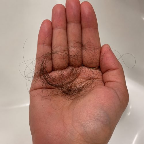 Hair Shedding